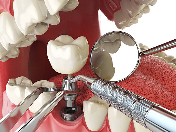 Best Weekend Emergency Dentist in St Augustine Beach, FL