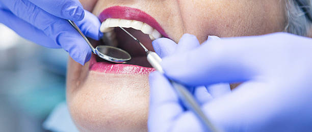 Best Emergency Root Canal Treatment in St Augustine Beach, FL